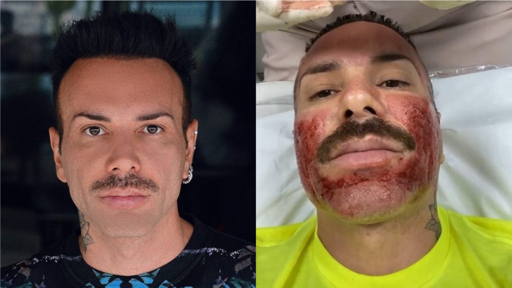 Matheus Mazzafera é cogitado para entrar BBB 21 (Foto: Reprodução/Internet)