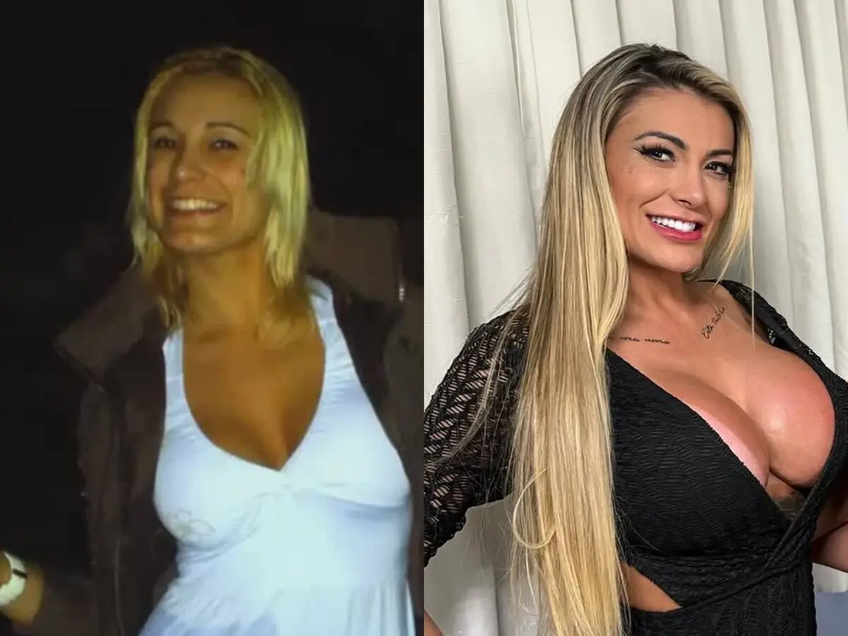 Antes e depois de Andressa Urach: vídeo mostra as mudanças da famosa ao longo dos anos