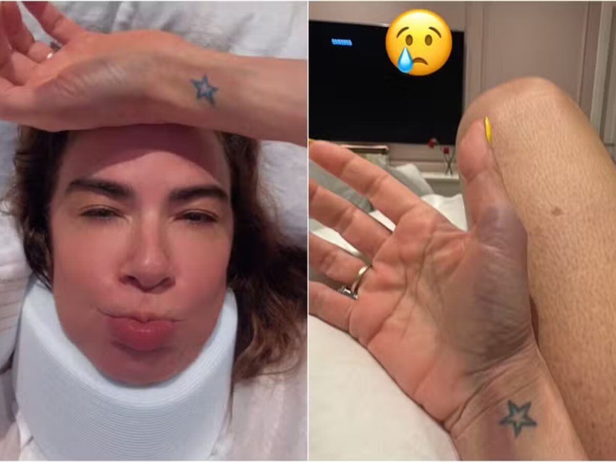 Luciana Gimenez mostra hematomas após cirurgia: 'Toda roxa'