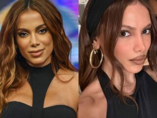 Anitta movimenta web ao surgir com novo rosto e internautas especulam cirurgia malsucedida